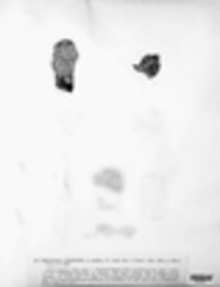 Pertusaria pertusa image